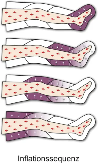 MESIS Pressothérapie appareil de massage PressoMassaggio Plus+ (avec 2 bottes et Kit Slim Body) - Drainage Lymphatique - À usage domestique et professionnel avec 2 jambières et Kit Slim Body